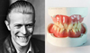 デヴィッド・ボウイの歯をリアルに再現した彫刻が話題に
