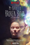 デヴィッド・リンチ製作ドキュメンタリー『My Beautiful Broken Brain』の予告編映像が公開