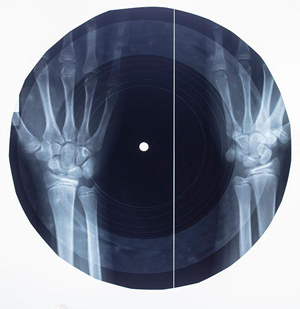 ソビエトで密かに作られた「レントゲン写真レコード」の再現