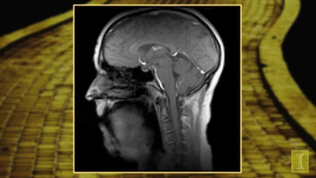 New Super-Fast MRI Technique: Singing 'If I Only Had a Brain'