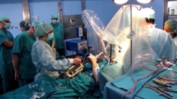 Man plays saxophone during his 12-hour brain surgery