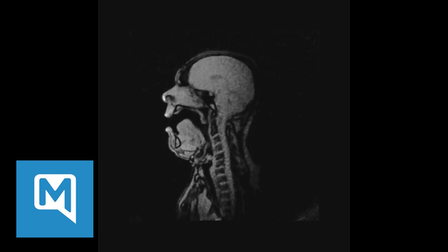 Opera Singer's Head With an MRI