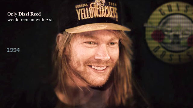 AXL ROSE, WHAT HAPPENED? Year To Year With Facial Transition - Angelo di Carpio