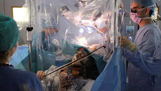 Patient plays violin while surgeons remove brain tumour