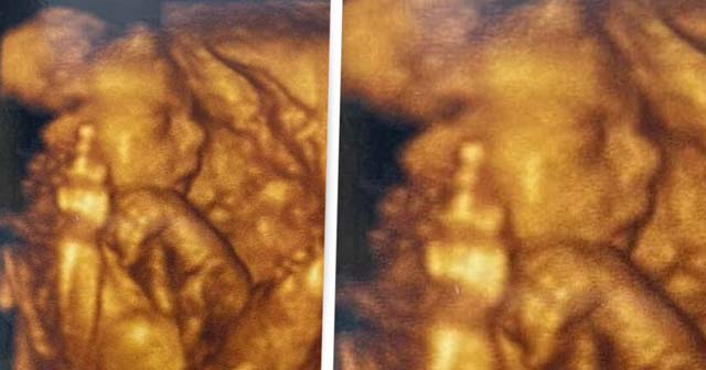 Unborn Baby Says ‘Goodbye To 2020’ With Middle Finger During Scan - Kennedy News and Media